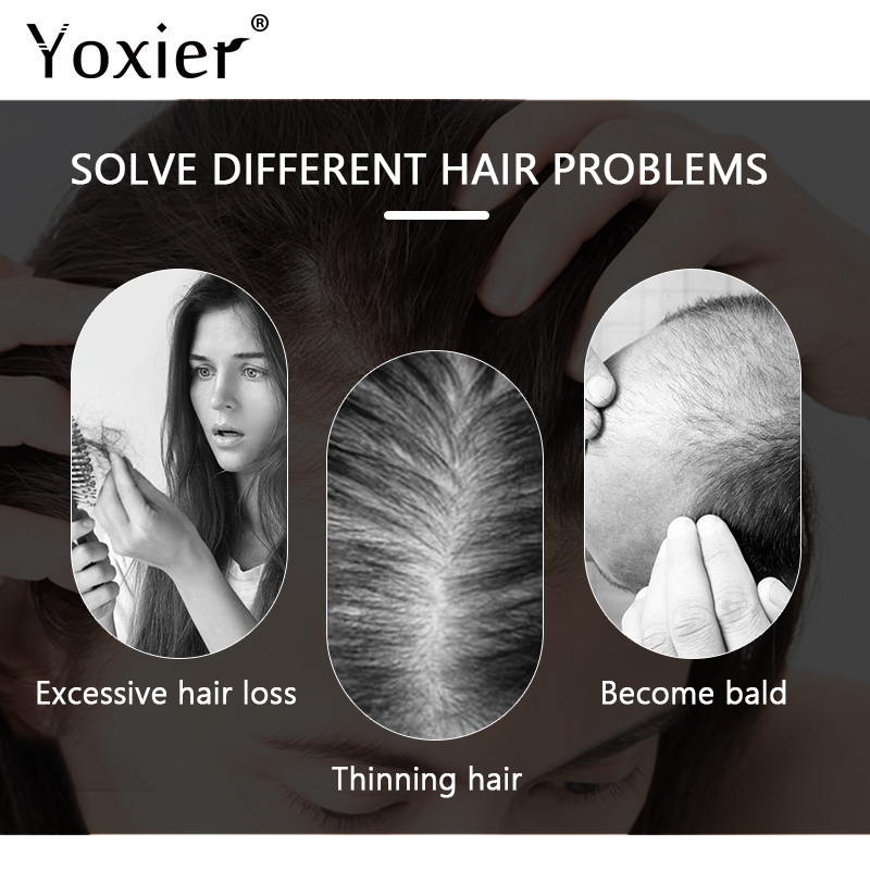 Intensieve Groei Serum Voorkom - Hair Care Treatment recensie en prijs
