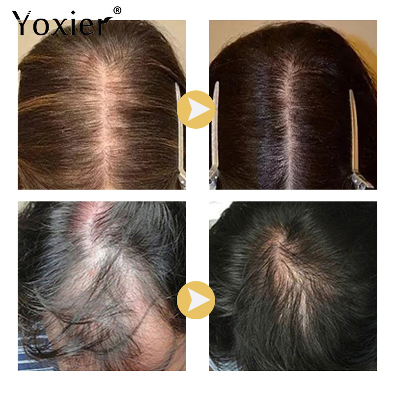 Intensieve Groei Serum Voorkom - Hair Care Treatment recensie en prijs