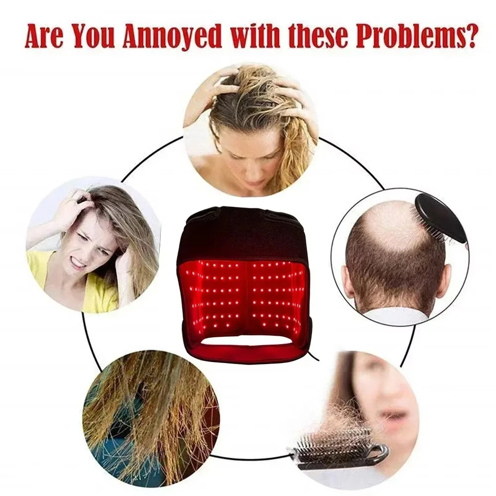 LED Rood Licht Therapie Hoed V - Hair Care With Protein recensie en prijs