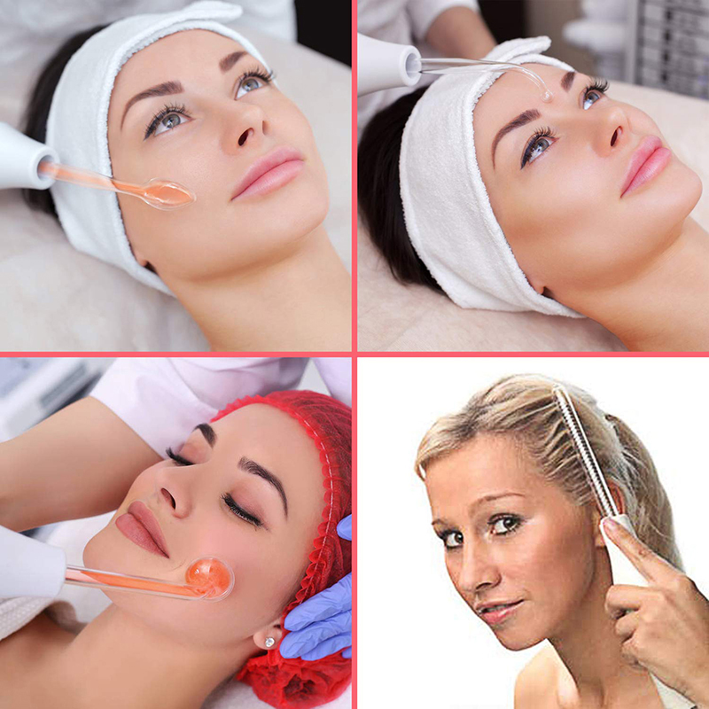Professionele Auto 4-in-1 Elek - Hair Care Treatment recensie en prijs